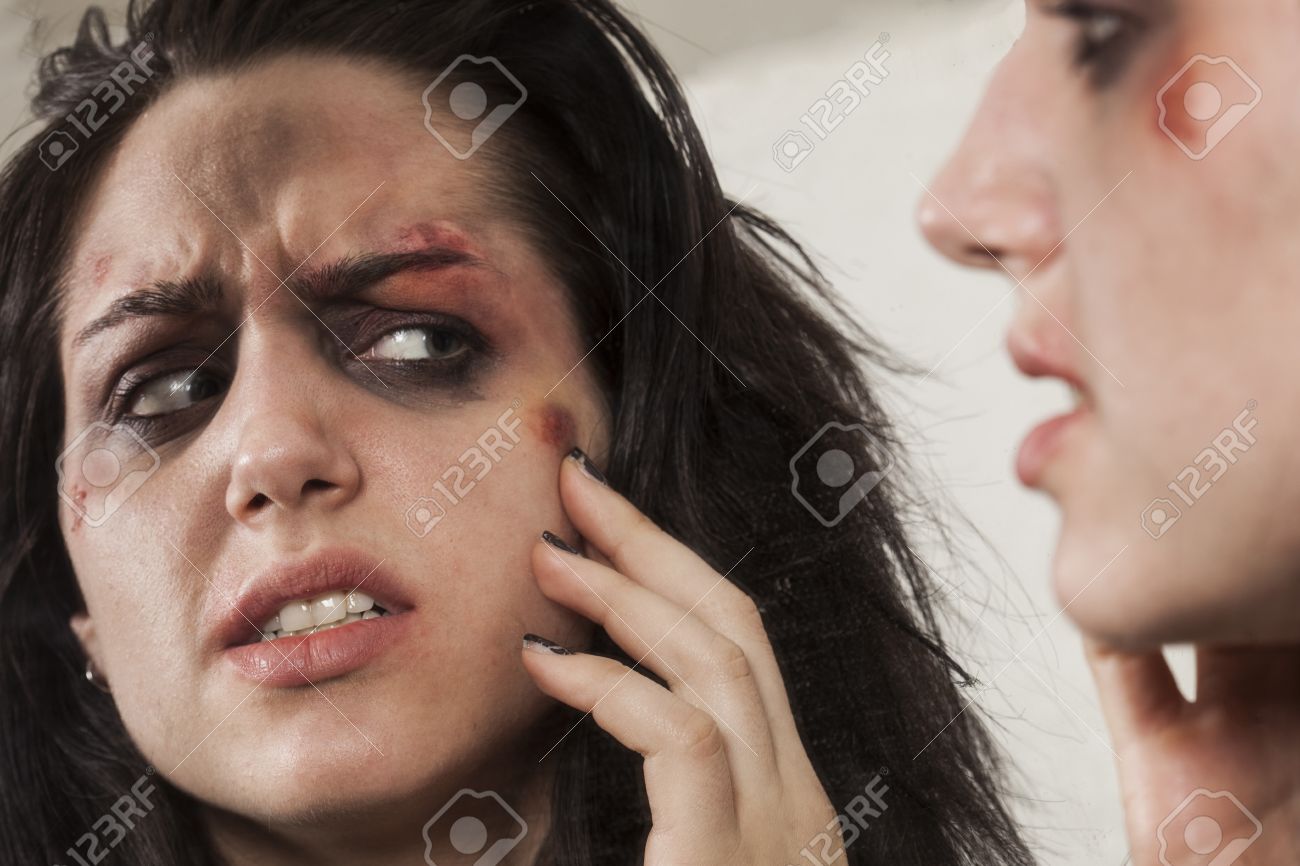 Sad Worried Beaten Up Girl With Wounds On Her Face Looking At Her  Reflection In The Mirror Stock Photo, Picture and Royalty Free Image. Image  27922711., image size:1300x866
