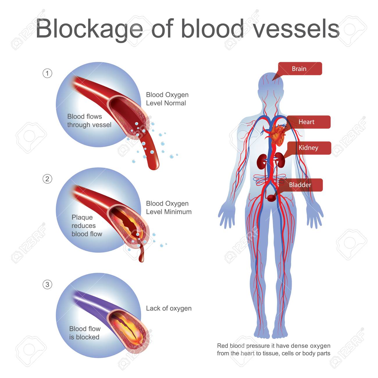 micción frecuente de la presión arterial micción frecuente de la presión arterial
