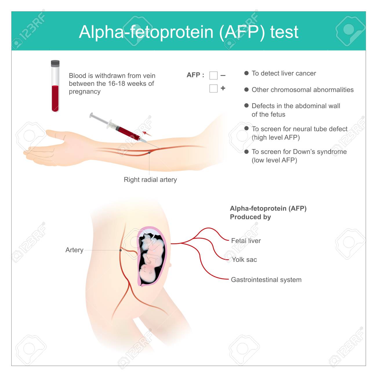 Pregnancy Test Prueba De Embarazo Alfa Prueba Afp Embarazo On Sale