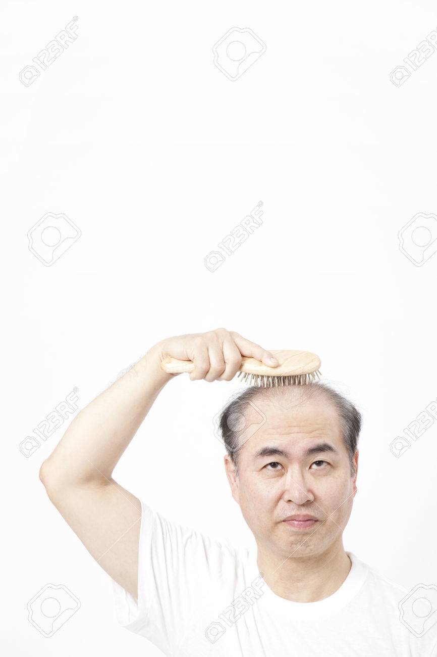 薄毛の男性のブラシで頭皮をタップします の写真素材 画像素材 Image