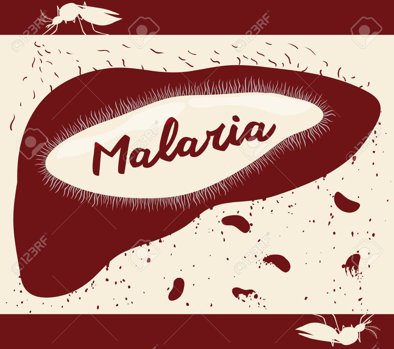 kurze lebenslauf des lebenszyklus der malarischen plasmodium krankheit ber die moskito und menschlichen krper in - Krankheit Im Lebenslauf kurze lebenslauf des lebenszyklus der malarischen plasmodium krankheit ber die moskito und menschlichen krper in - Krankheit Im Lebenslauf