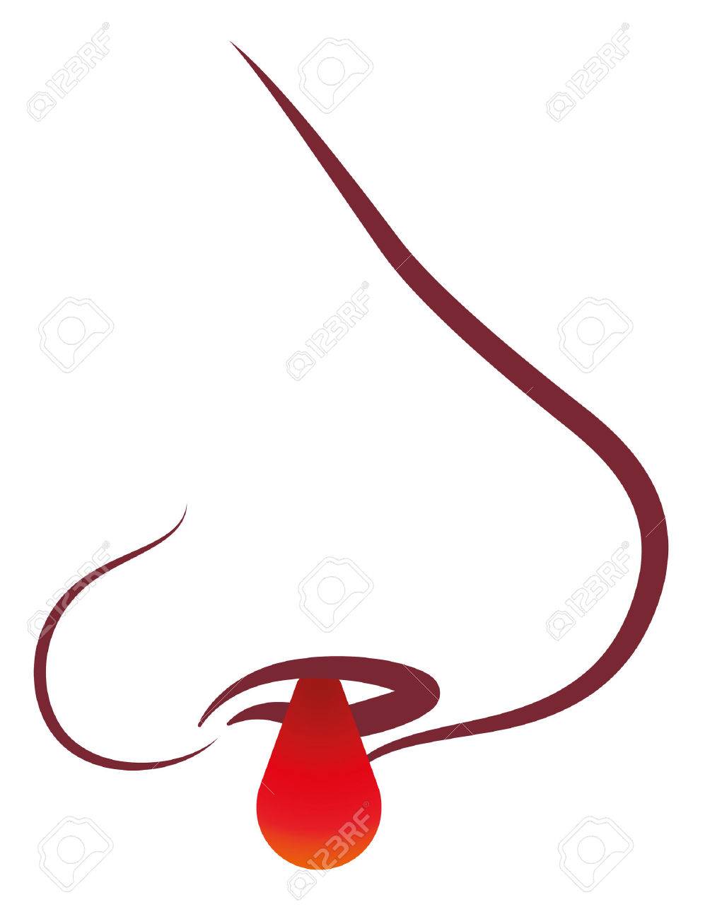 白い背景の上の鼻出血分離ベクトルの鼻出血審美的なイラスト のイラスト素材 ベクタ Image