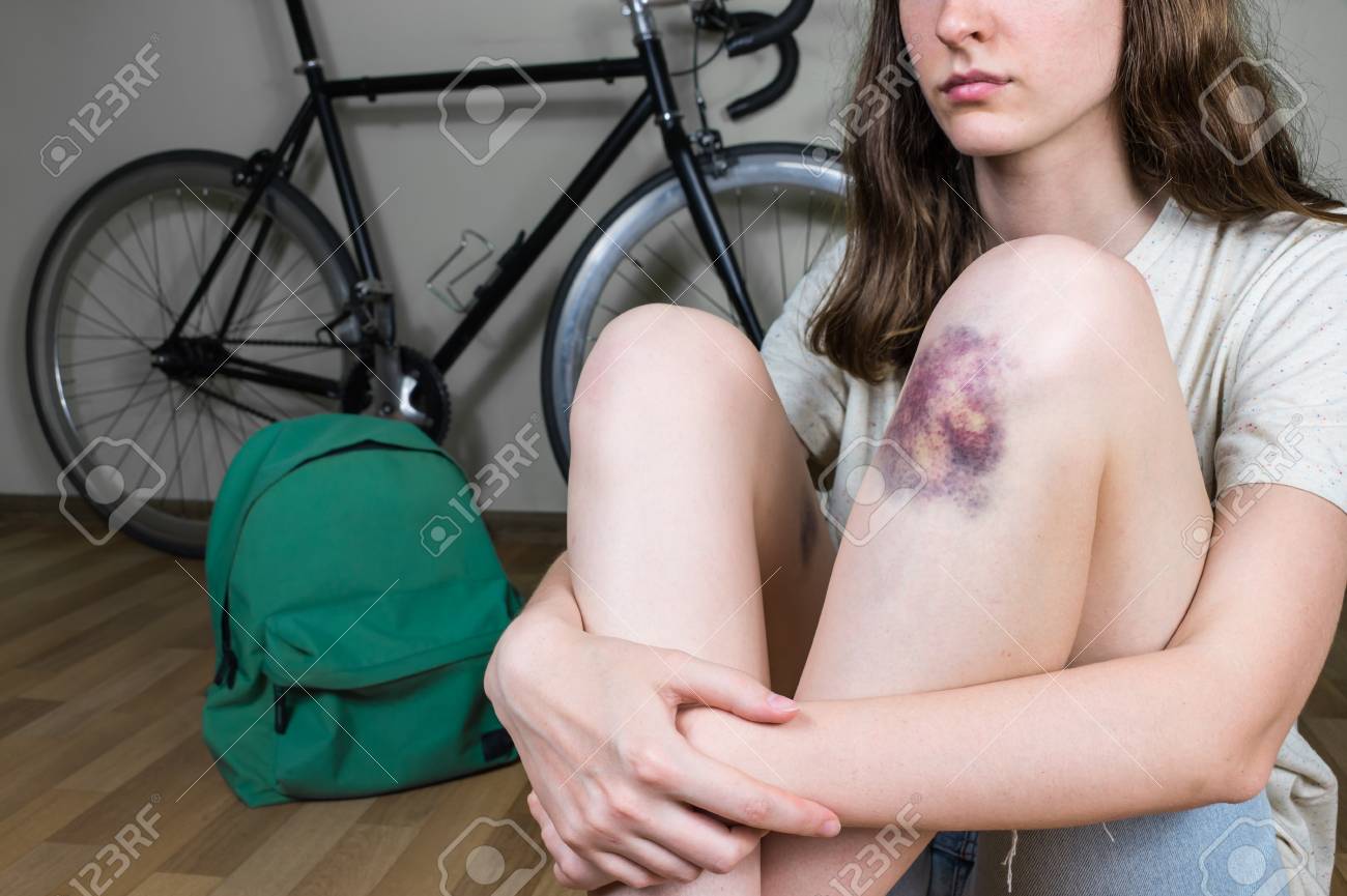 自転車傷ついていますが買って下さい