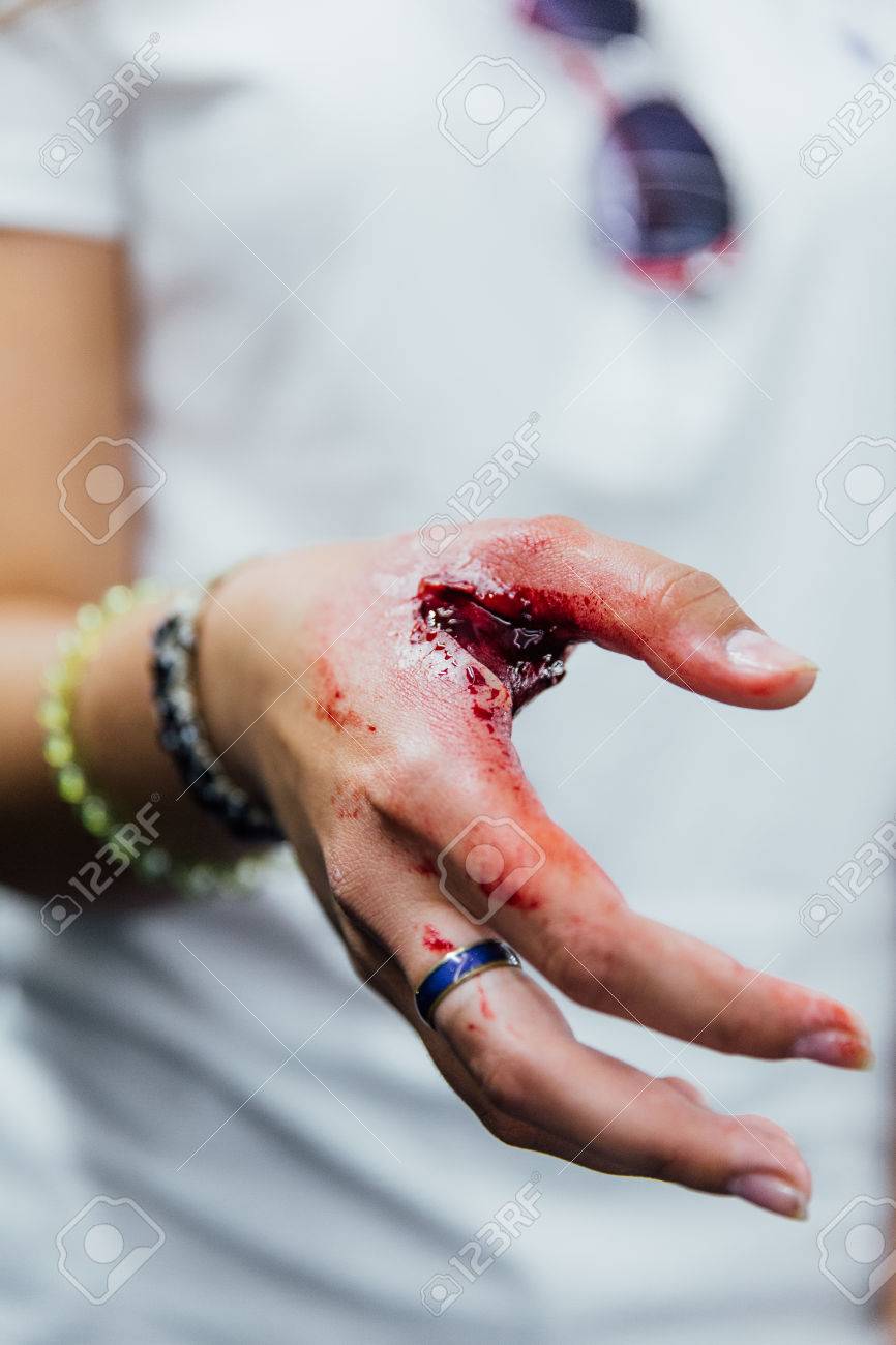 Deep Cut Between The Fingers On The Girls Hand. Blood, Pain. Violation Of  Safety Regulations. Stock Photo, Picture and Royalty Free Image. Image  80699644.