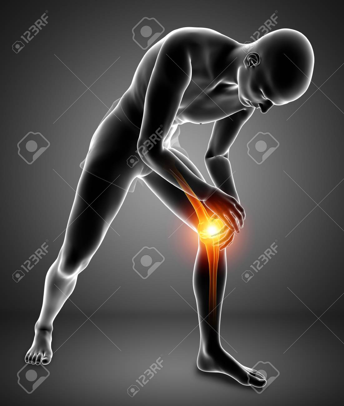 3 D イラストの男性膝の痛み の写真素材 画像素材 Image 70452704