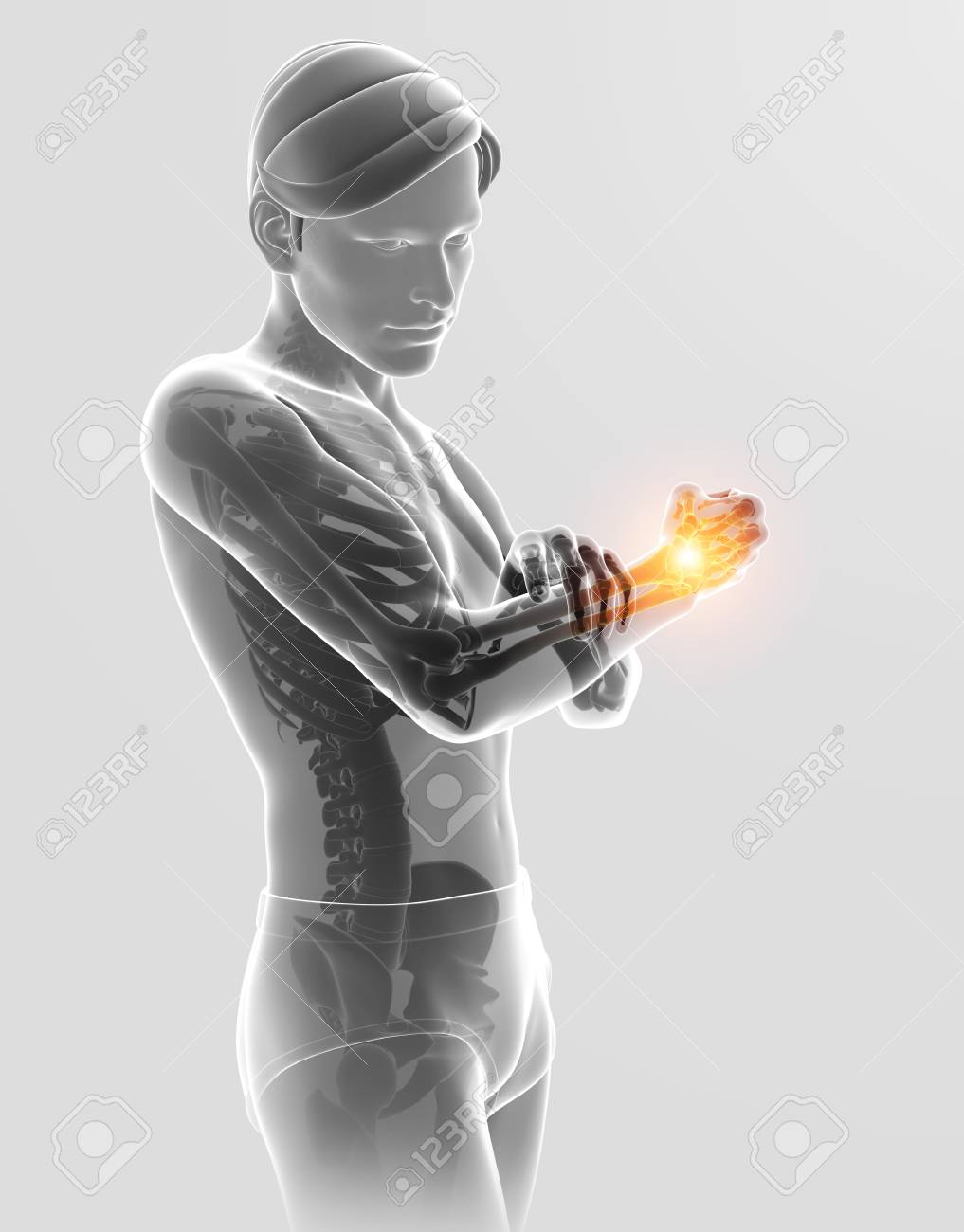 3 D イラストの男性感肘の痛み の写真素材 画像素材 Image 3 D イラストの男性感肘の痛み の写真素材 画像素材 Image
