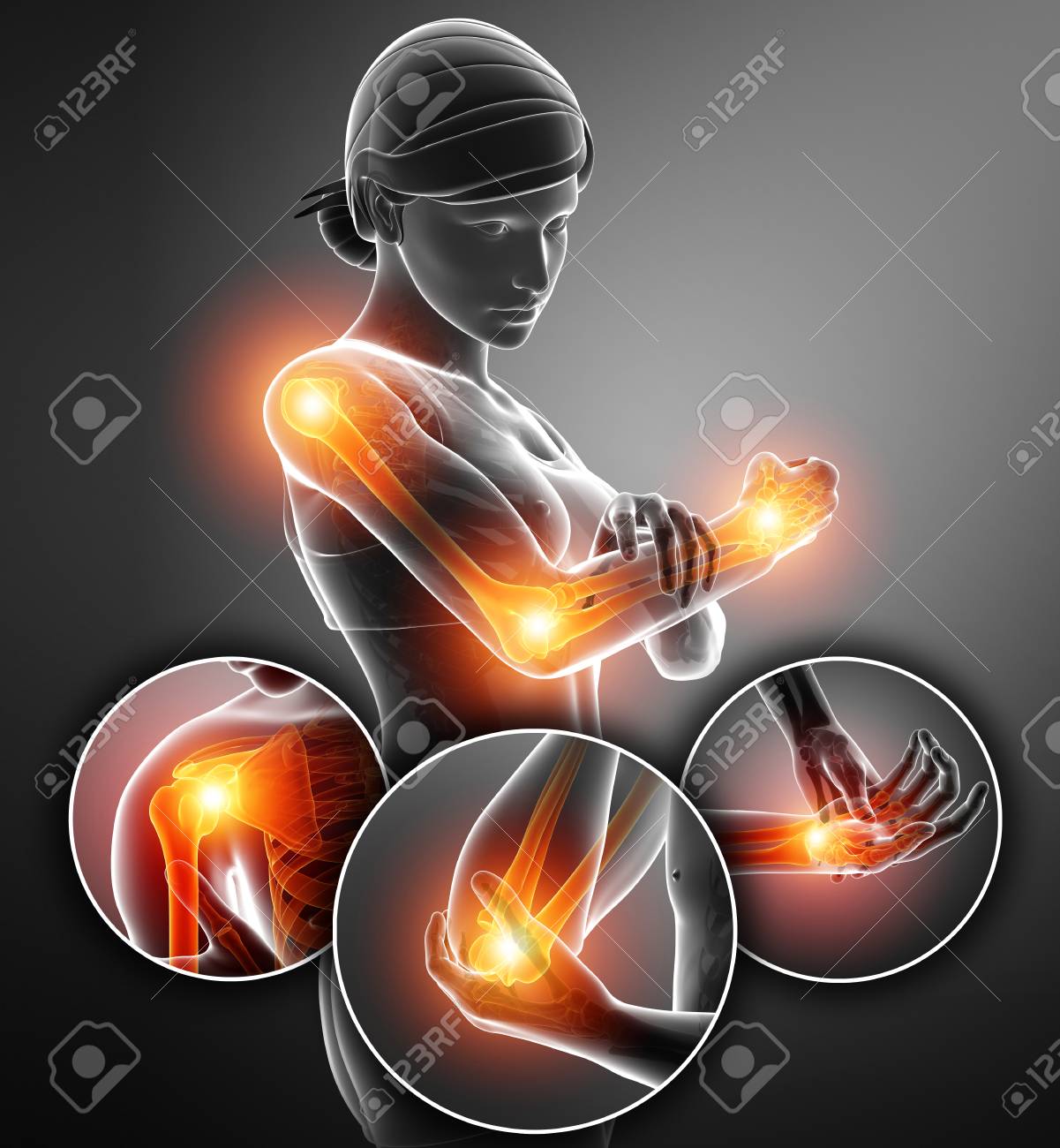 dolor articular femenino dolor articular femenino