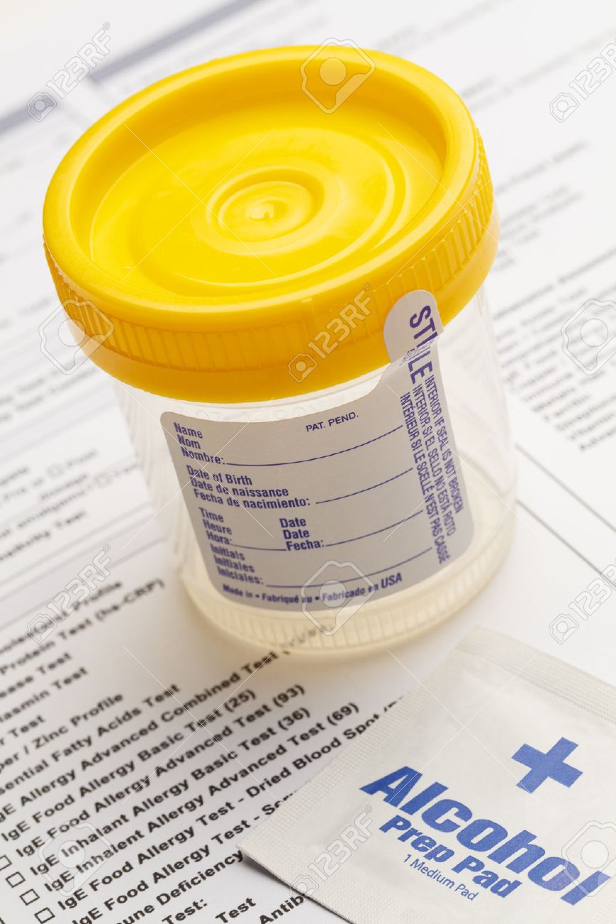 Urine Sample Cup with Wipe and Test Chart. - 38386492 Urine Sample Cup with Wipe and Test Chart. - 38386492