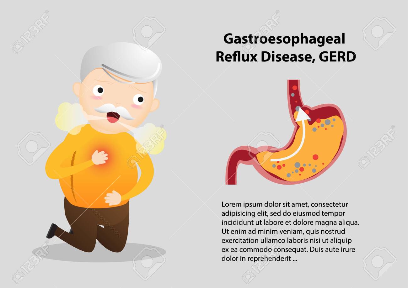 Acid reflux causes stomach pain Acid reflux causes stomach pain