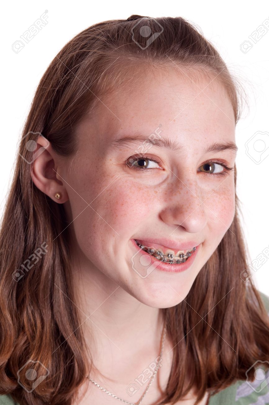 Young Girls With Braces On Teeth