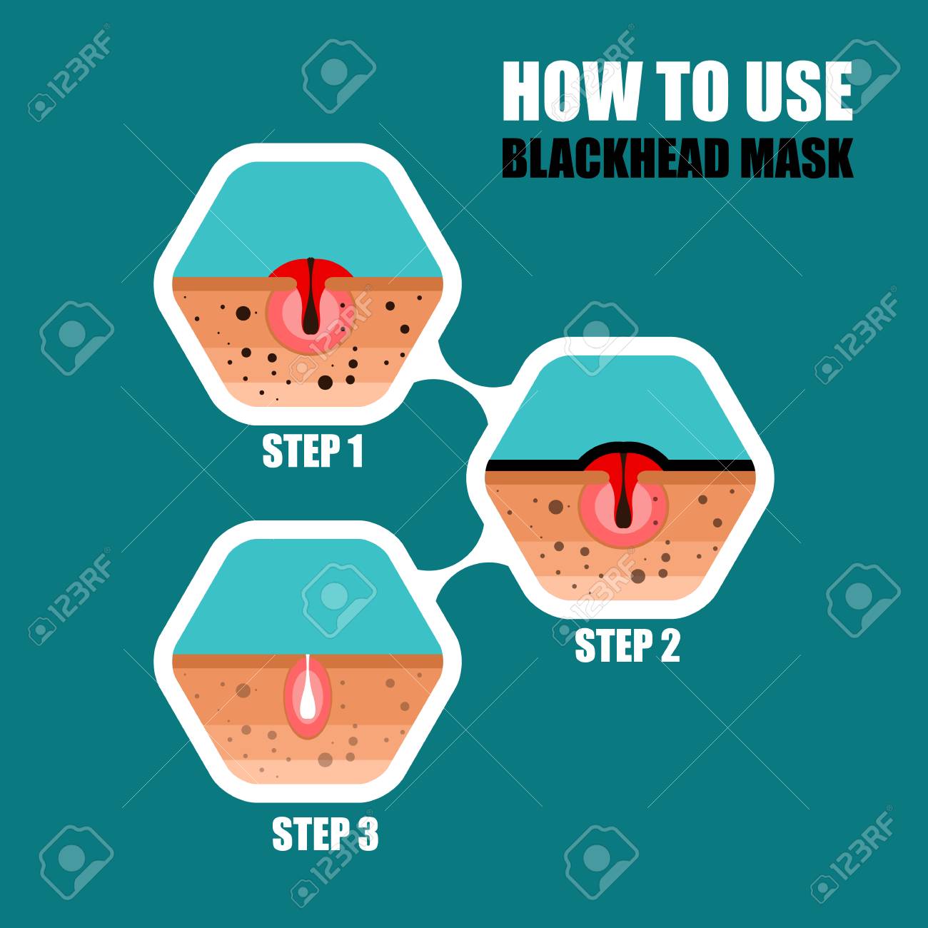 肌の問題の現代のベクトルイラスト 濃い点 にきび Faのイラスト素材 ベクタ Image