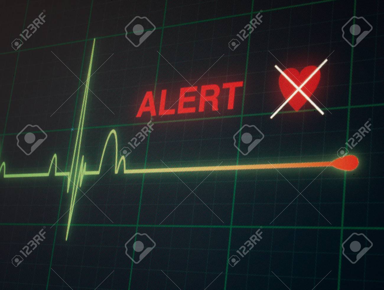 Flat Line Alert On A Heart Monitor Stock Photo Picture And Royalty Free Image Image 37493828