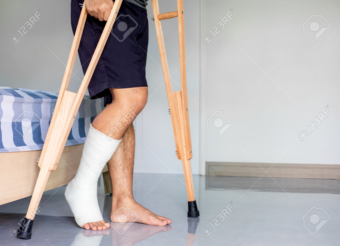 Close-Up Patient With Broken Leg In Cast And Bandage, Man With Leg.