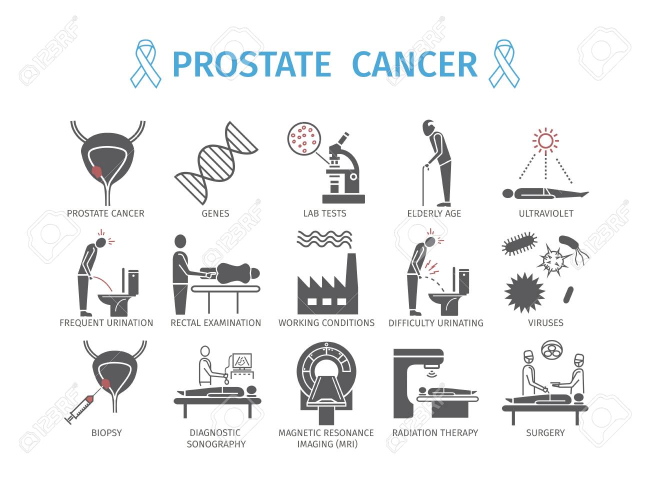 prostata biopsia magyarul