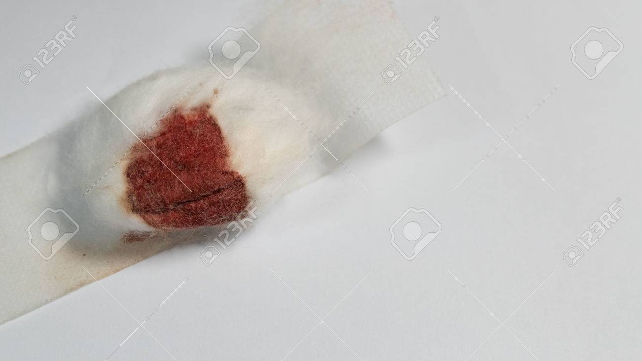La hemostasia sobre concepto