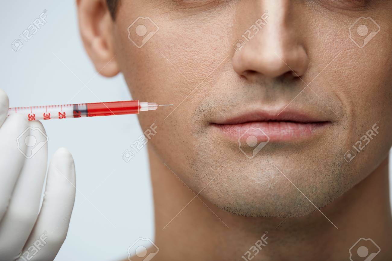 美容トリートメント 唇しわを減らすために肌の顔の美しさの注射を取得するハンサムな男のクローズ アップ 男性患者の口に注入を行う美容師のクローズ アップ 美容 高分解能 の写真素材 画像素材 Image