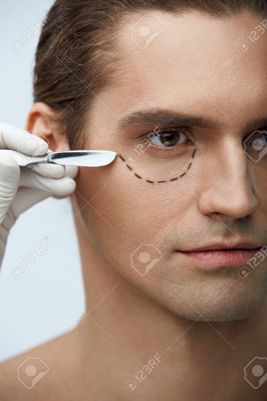 Plastic Surgery Closeup Of Handsome Male Face With Black Marks