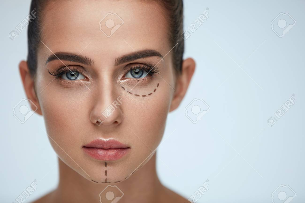 Plastic Surgery Operation Closeup Beautiful Young Woman Face Stock Photo Picture And Royalty Free Image Image 75848710