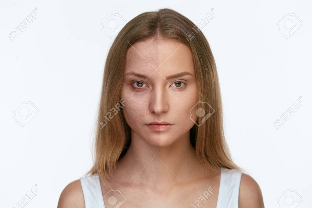 高解像度　画像　女 化粧。ファンデーションの有無にかかわらず美しい女性の顔。高解像度。の写真素材・画像素材 Image 100516914