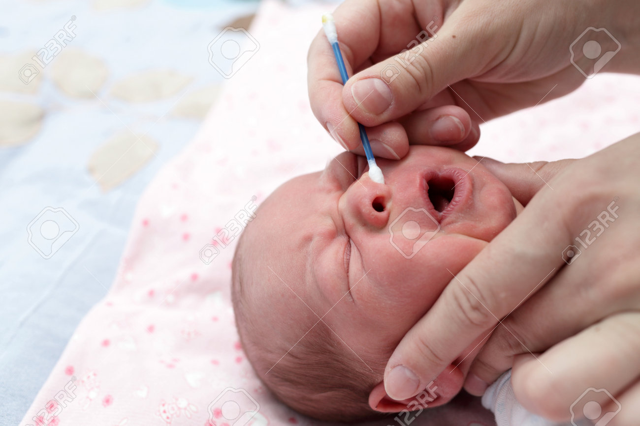 泣いている赤ちゃん綿棒で鼻を洗浄 の写真素材 画像素材 Image