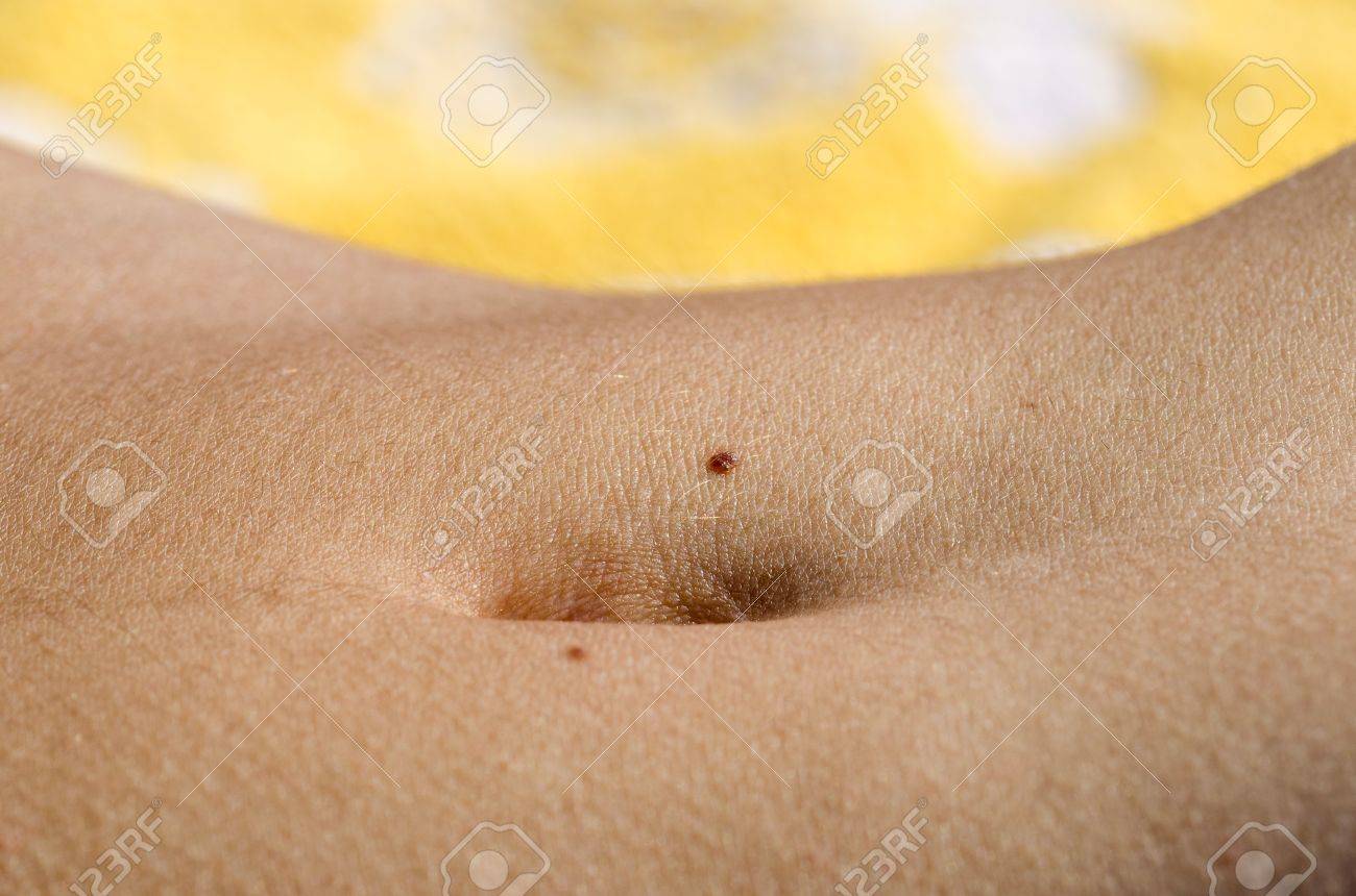 Girl Bellybutton With Two Moles Closeup Stock Photo, Picture and Royalty  Free Image. Image 21687893., image size:1300x860