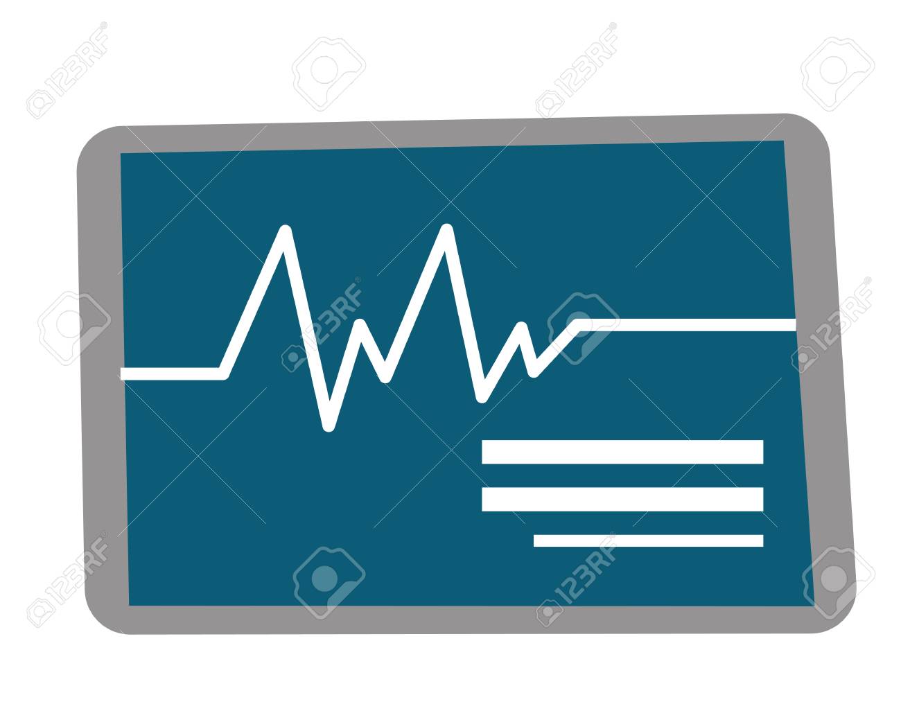 心拍数モニター心拍数を測定します 医療診断機器 ベクトル漫画イラスト白背景に分離されました のイラスト素材 ベクタ Image