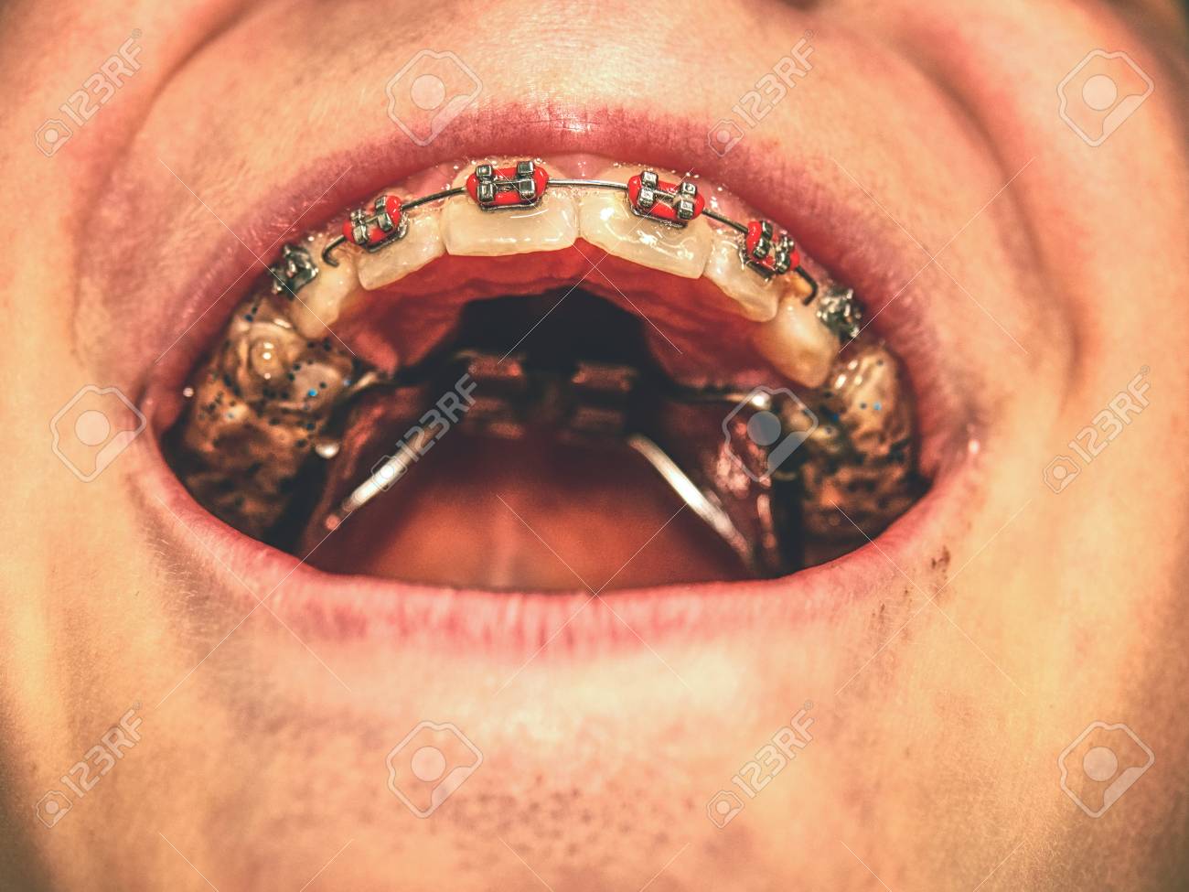 Soporte Para Cepillo De Dientes De Baño Con Bandeja De Drenaje