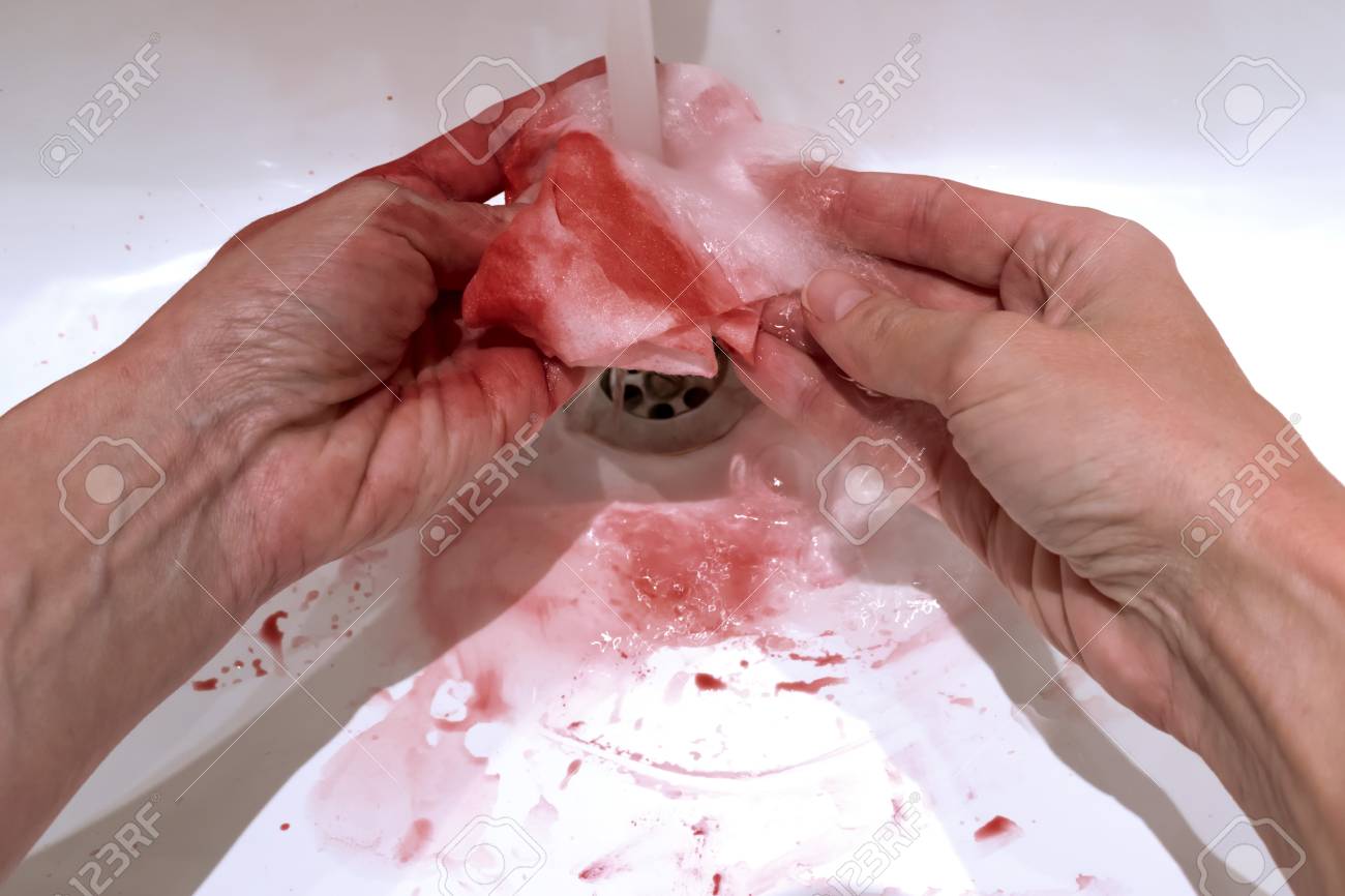 Bloody Hands, Holding A Bloody Tissue And Washing It In The Bathroom Sink,  Bleeding, Criminal And Suicide Concept. Фотография, картинки, изображения и  сток-фотография без роялти. Image 111117418