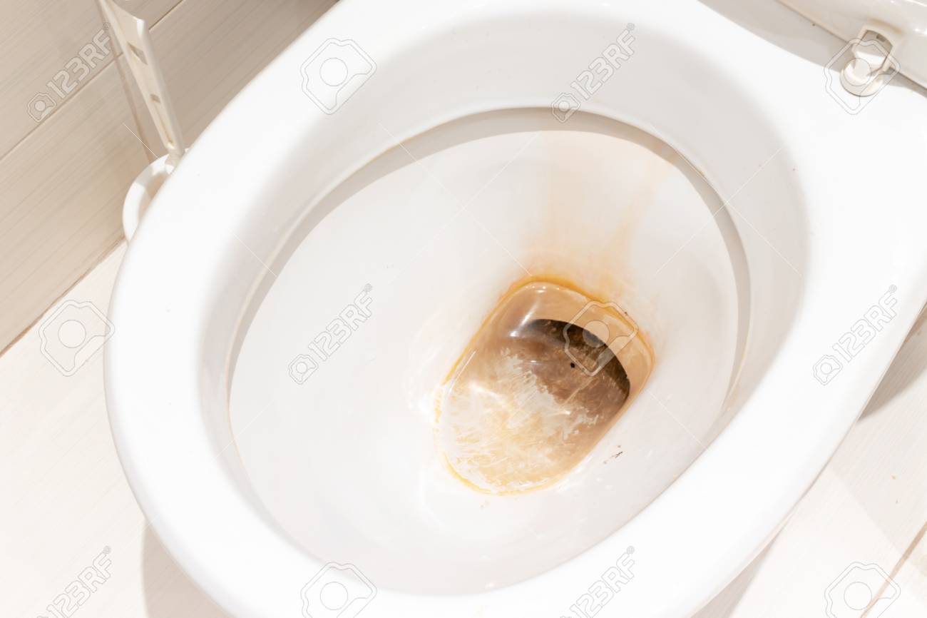 Dirty Unhygienic Toilet Bowl With 