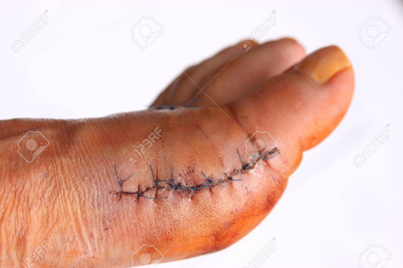 etiam-dictum-ipsum-a-felis