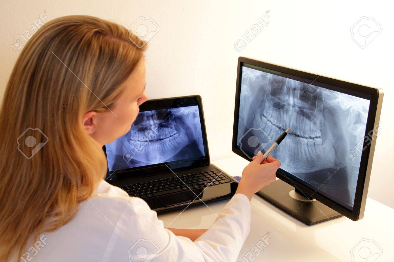 Dentistry explains a dental X-Ray - 15045159 Dentistry explains a dental X-Ray - 15045159