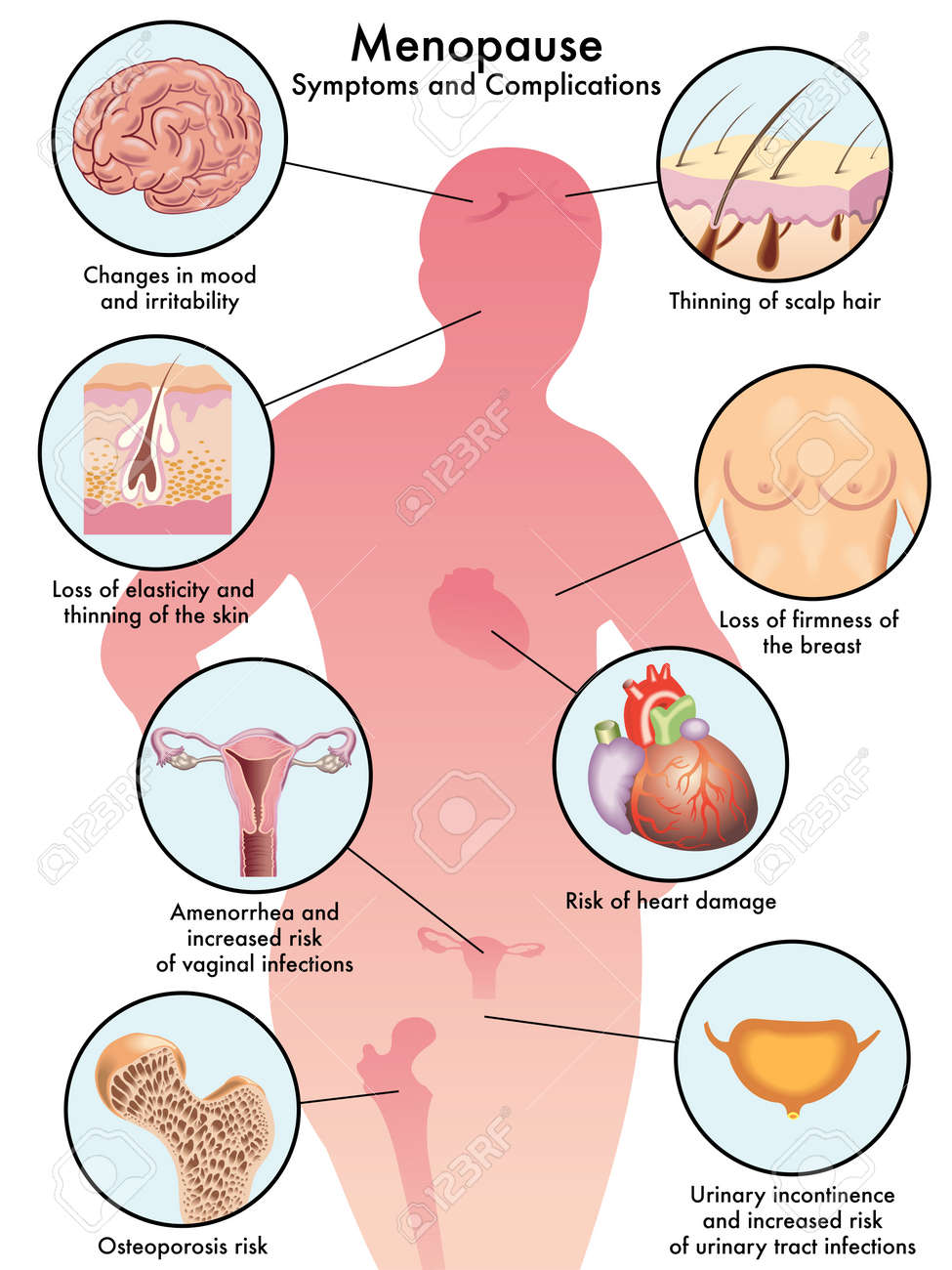 Does ct medicaid cover weight loss surgery image 5