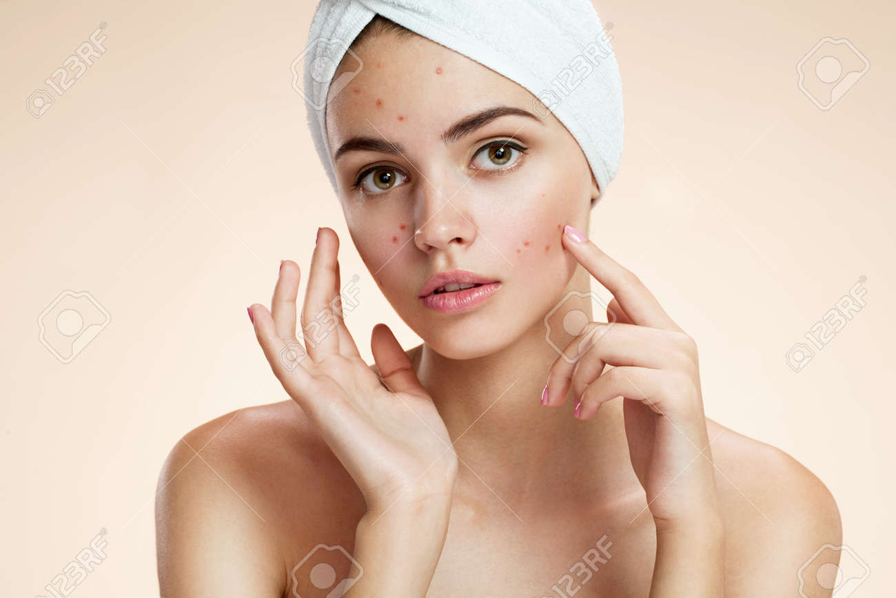 Problem skin 97 Problem skin 57