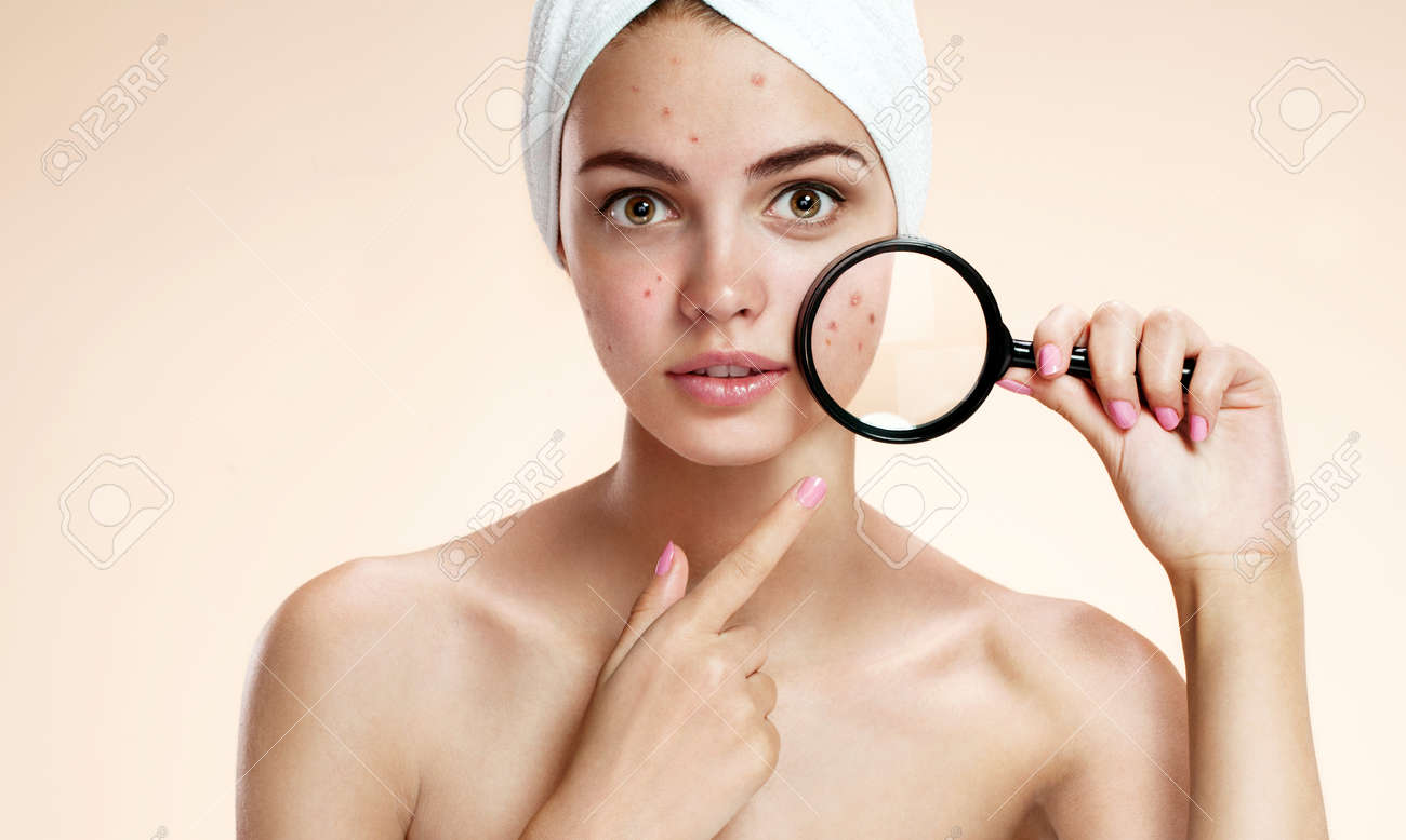 Problem skin 91 Problem skin 76