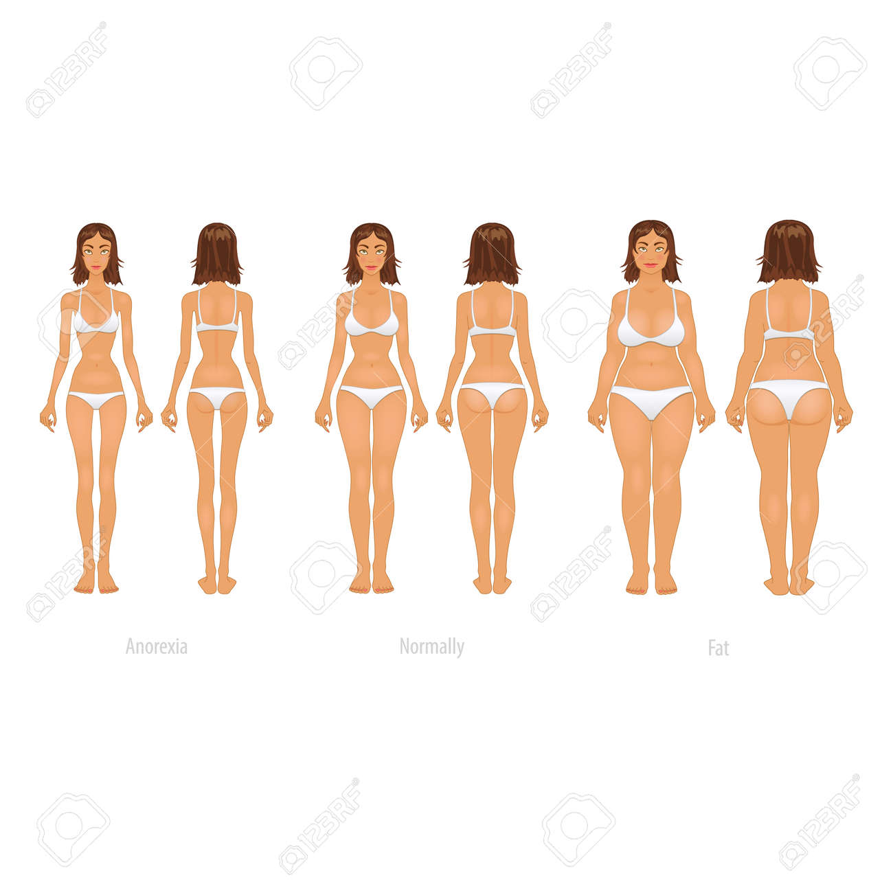 ベクトルのイラストさまざまなボディタイプ 整形手術の前後 のイラスト素材 ベクタ Image