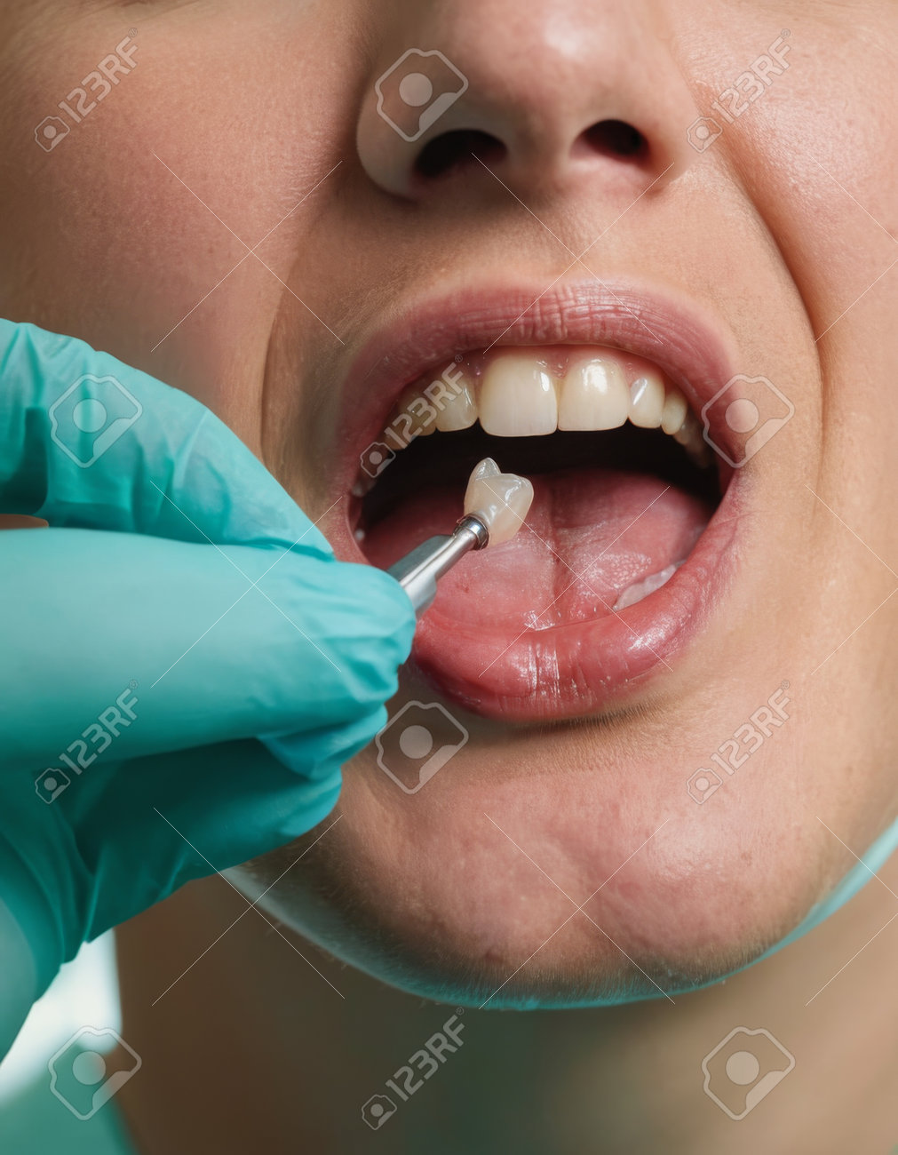 etiam-dictum-ipsum-a-felis