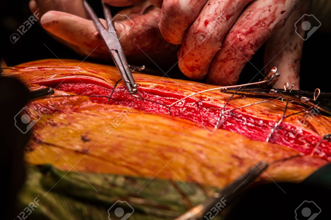 etiam-dictum-ipsum-a-felis