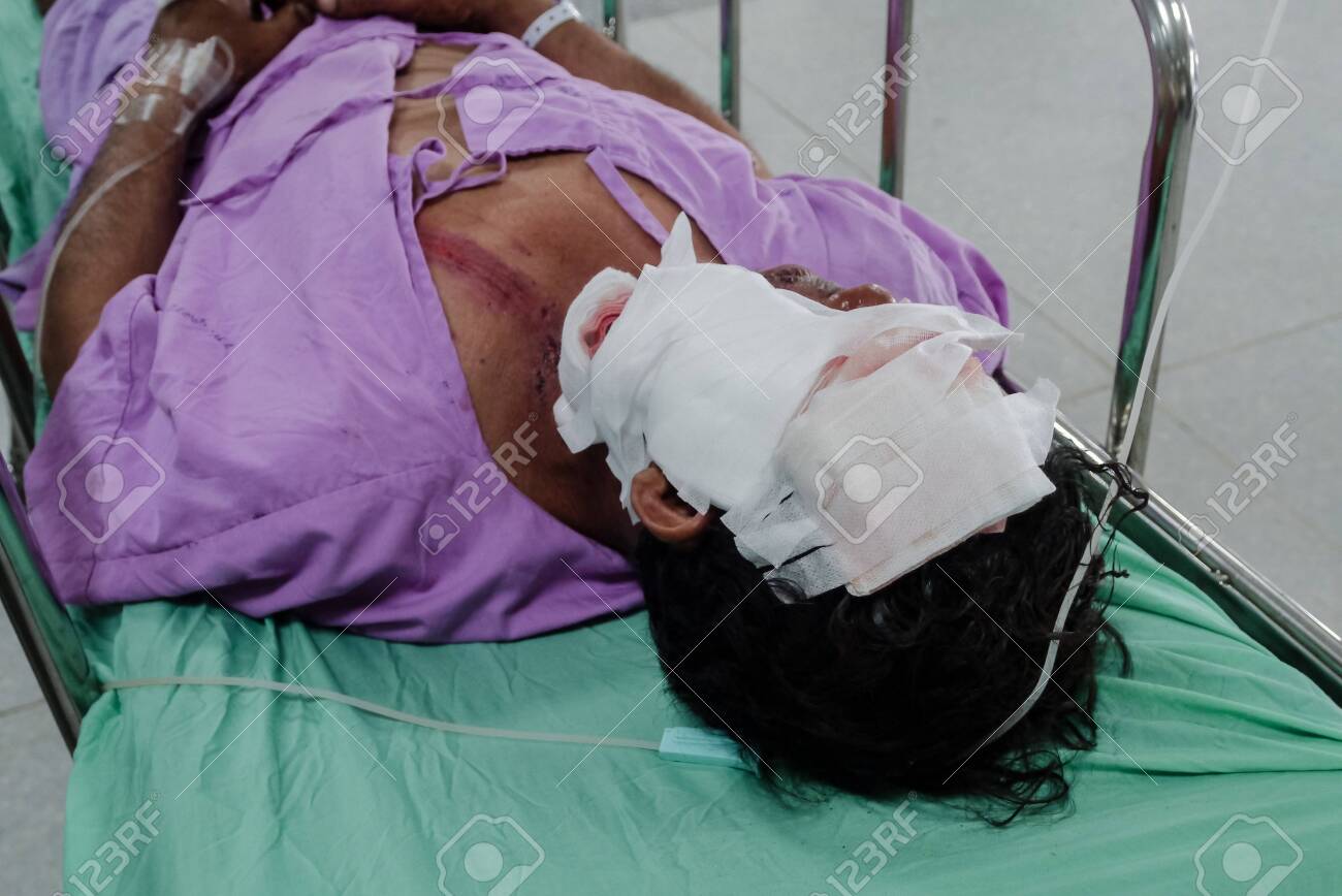Patients with severe wound on face. - 127826692 Patients with severe wound on face. - 127826692