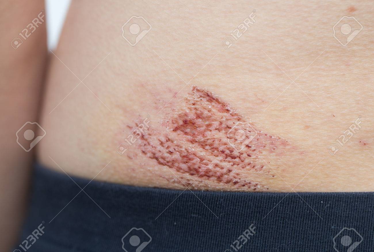 etiam-dictum-ipsum-a-felis