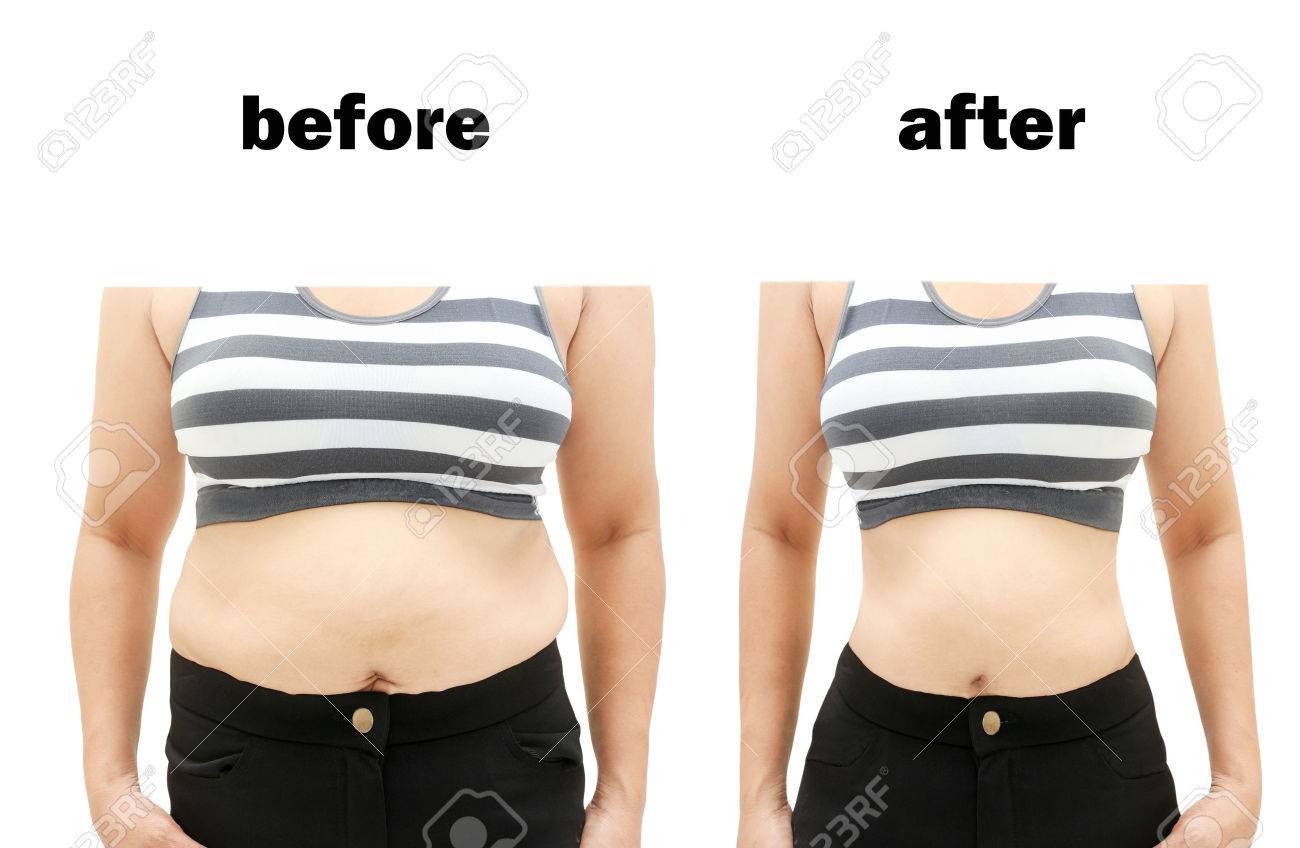 Metaboltonics vor und nach dem Abnehmen Metaboltonics vor und nach dem Abnehmen