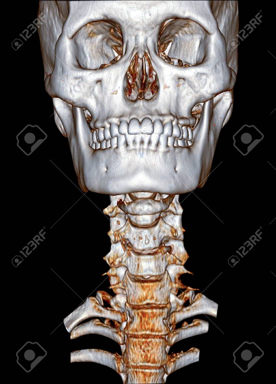 頭頸部画像解剖ナビゲーション = NAVIGATION OF IMAGING … 3D Rendering Imaging Of Cervical Spine (C-spine) Front View