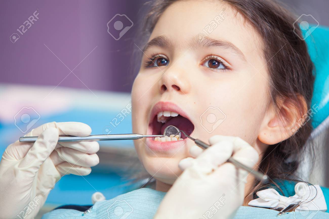 Close-up of pretty little girl opening his mouth wide during treating her teeth by the dentist - 73413924 Close-up of pretty little girl opening his mouth wide during treating her teeth by the dentist - 73413924