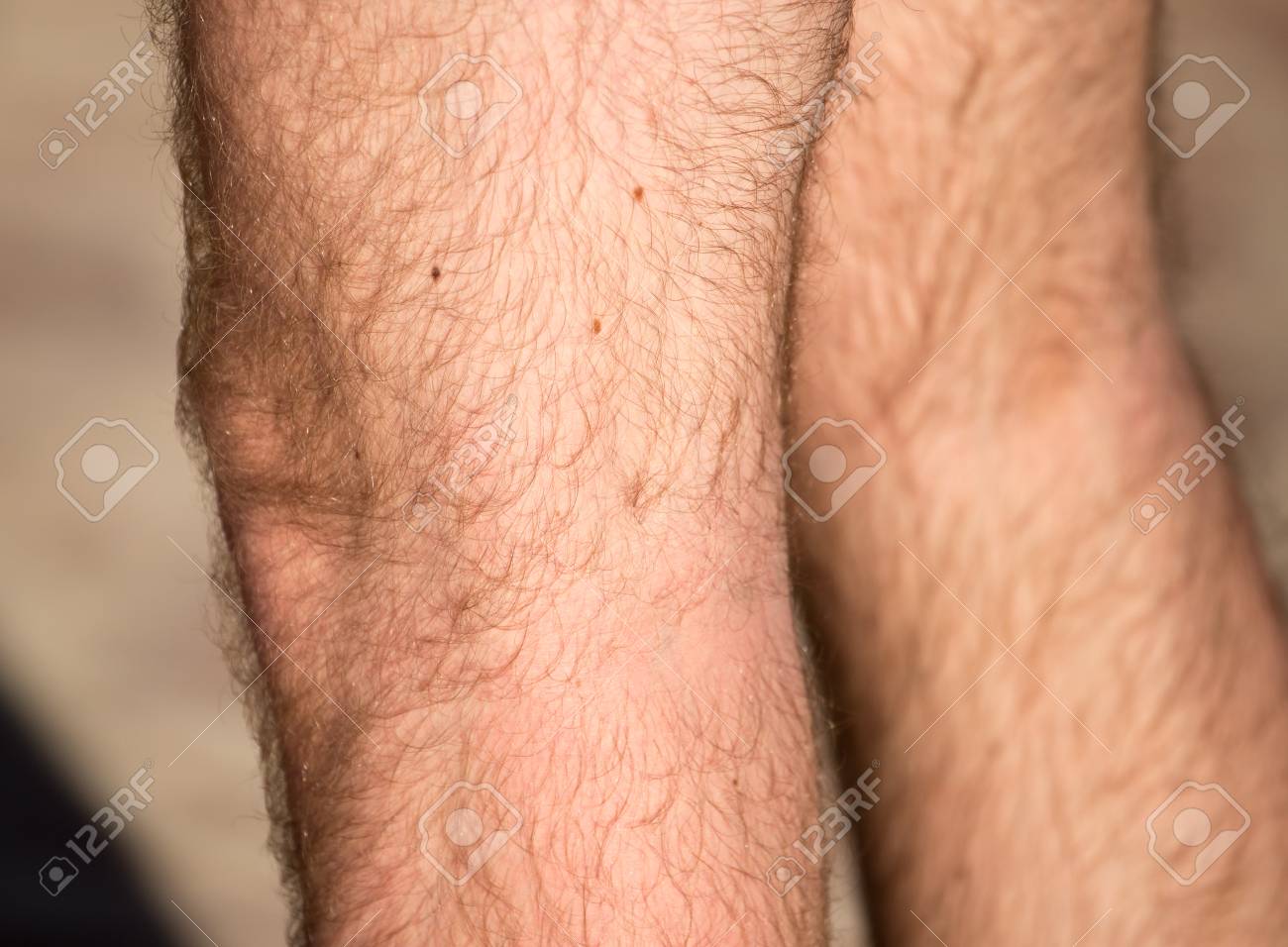 男の足の毛 の写真素材 画像素材 Image 男の足の毛 の写真素材 画像素材 Image