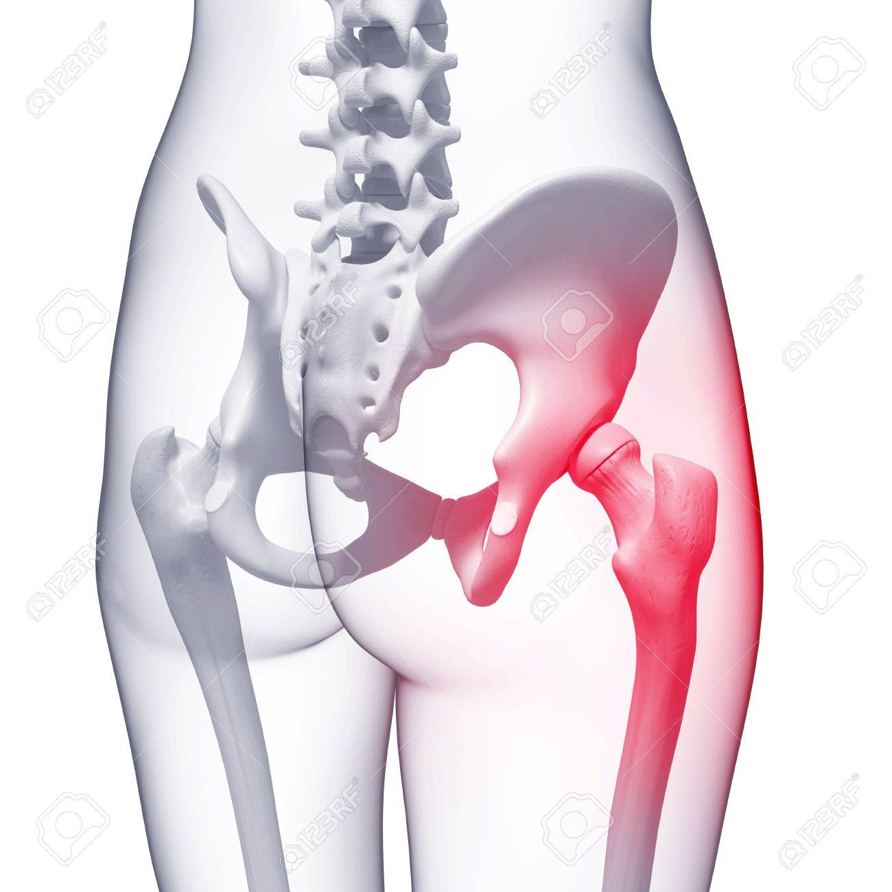 dolor pélvico xl dolor pélvico xl