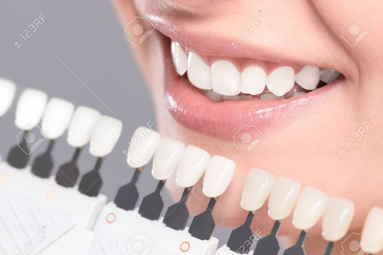 Beautiful smile and white teeth of a young woman. Matching the shades of the implants or the process of teeth whitening. - 75086049 Beautiful smile and white teeth of a young woman. Matching the shades of the implants or the process of teeth whitening. - 75086049