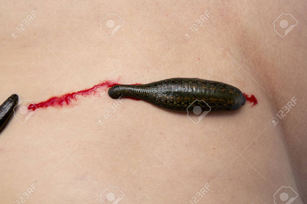 leeches for fishing