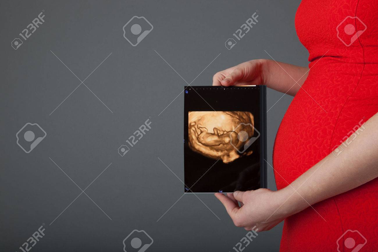 Pregnant woman showing her belly and ultrasound picture of the baby - 60059151 Pregnant woman showing her belly and ultrasound picture of the baby - 60059151