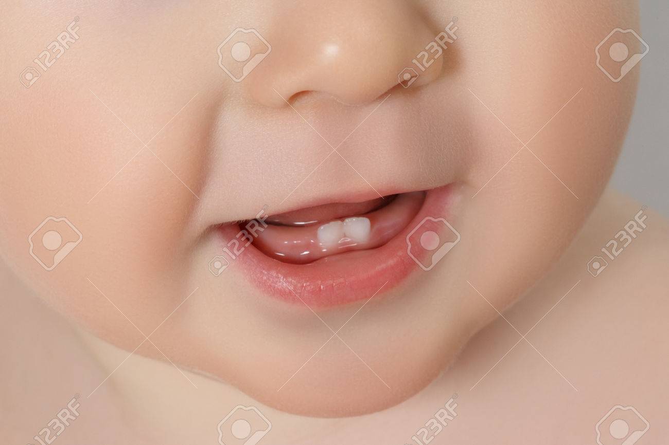 Close Up Baby Mouth With Two Rises Teeth Stock Photo Picture And Royalty Free Image Image Close Up Baby Mouth With Two Rises Teeth Stock Photo Picture And Royalty Free Image Image