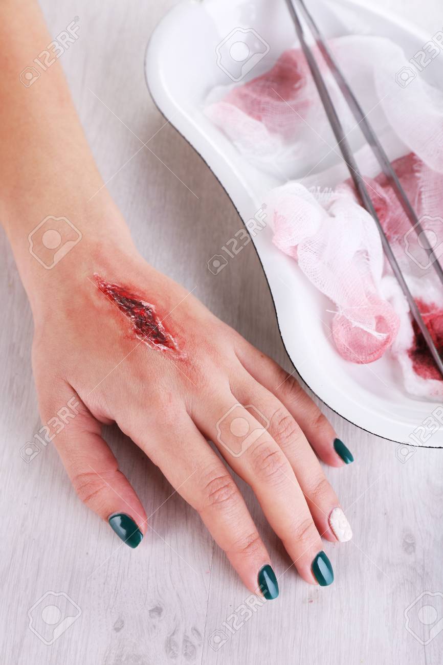 Injured Hand With Blood On Table In Hospital Stock Photo Picture And Royalty Free Image Image