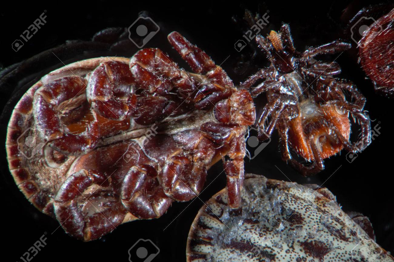 Microscopic Parasites >> Microscopic Parasites Ticks Mites Dermacentor Reticulatus Or Microscopic Parasites >> Microscopic Parasites Ticks Mites Dermacentor Reticulatus Or